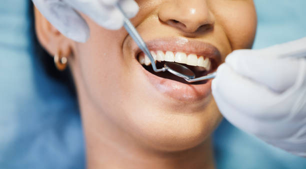 Best Emergency Cosmetic Dentistry (e.g., broken veneers) in Loch Lomond, VA